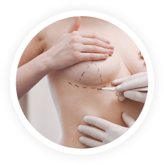 Breast Surgery